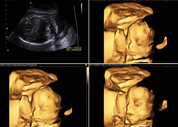 Fetal Morphology  